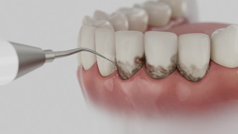 Reliable Dental contractor in Galveston, IN by Dentist Open Now